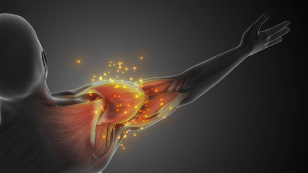 The Non Linear Risk Of Ignoring A Muscle Defect