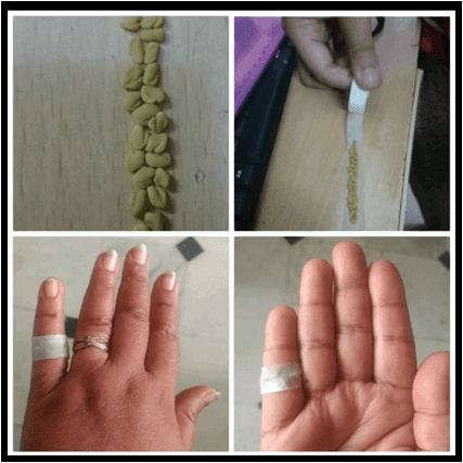 Unlocking the Secrets of Ayurvedic Acutherapy and its Uses