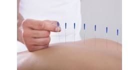 Acupuncture-Back-Pain