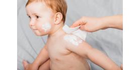 Infant Allergy: Here Are a Few Things You Need to Know