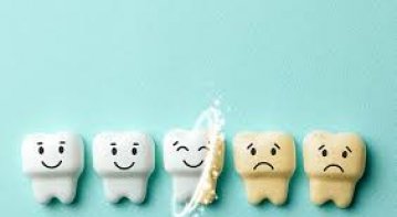 The Hidden Protector: Discovering the Magic of Fissure Sealants