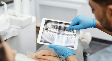 Exploring Suboxone's Unexpected Link to Tooth Decay and Oral Infections