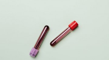 A beginner-friendly assortment of home blood test kits arranged on a clean table, including finger-prick devices, test strips, and sample collection tubes, with an instruction manual and smartphone app displayed beside them.