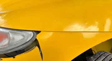 Person resting and reflecting during recovery, symbolizing physical and mental healing after a car accident.