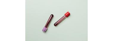 A beginner-friendly assortment of home blood test kits arranged on a clean table, including finger-prick devices, test strips, and sample collection tubes, with an instruction manual and smartphone app displayed beside them.