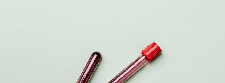 A beginner-friendly assortment of home blood test kits arranged on a clean table, including finger-prick devices, test strips, and sample collection tubes, with an instruction manual and smartphone app displayed beside them.