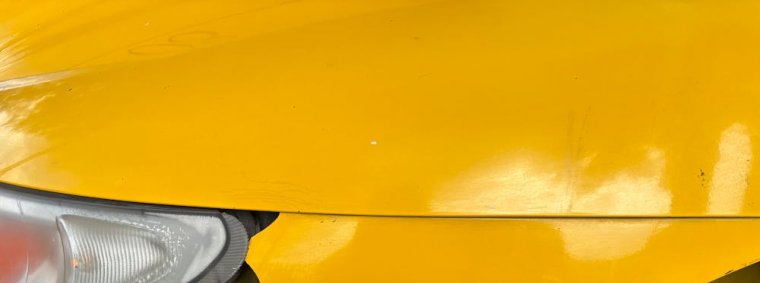 Person resting and reflecting during recovery, symbolizing physical and mental healing after a car accident.